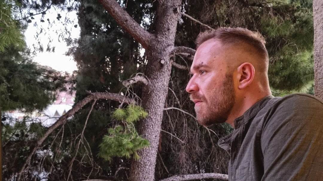 Ivan Pažanin odlučio se za transplantaciju kose