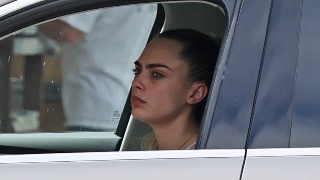 Cara Delevingne se bori s psorijazom