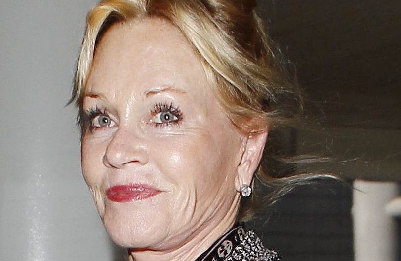 Melanie Griffith s ožiljkom na licu