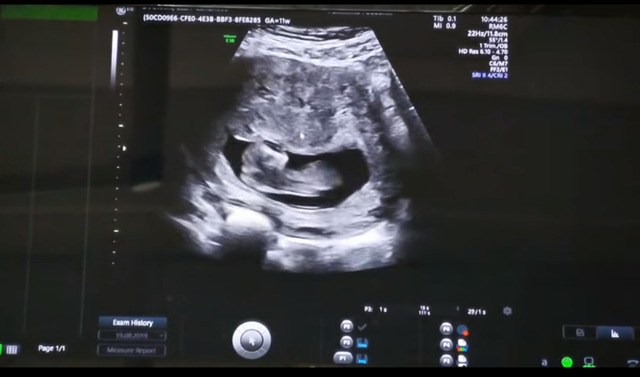 VIDEO POKAZAO Suprug Elle Dvornik nije bio oduševljen drugom trudnoćom