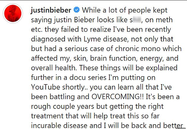 PRIZNAO Justin Bieber: 'Ne drogiram se, imam dvije opake bolesti'
