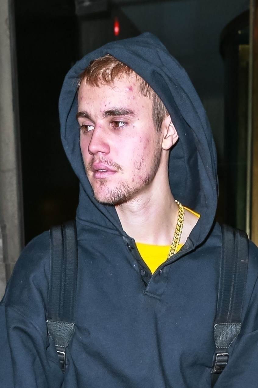 PRIZNAO Justin Bieber: 'Ne drogiram se, imam dvije opake bolesti'