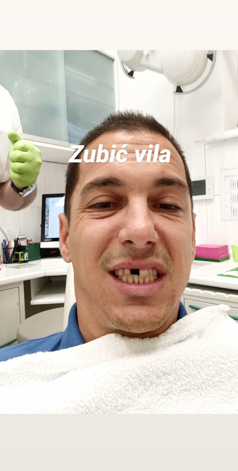 Mario Valentić ostao bez zuba