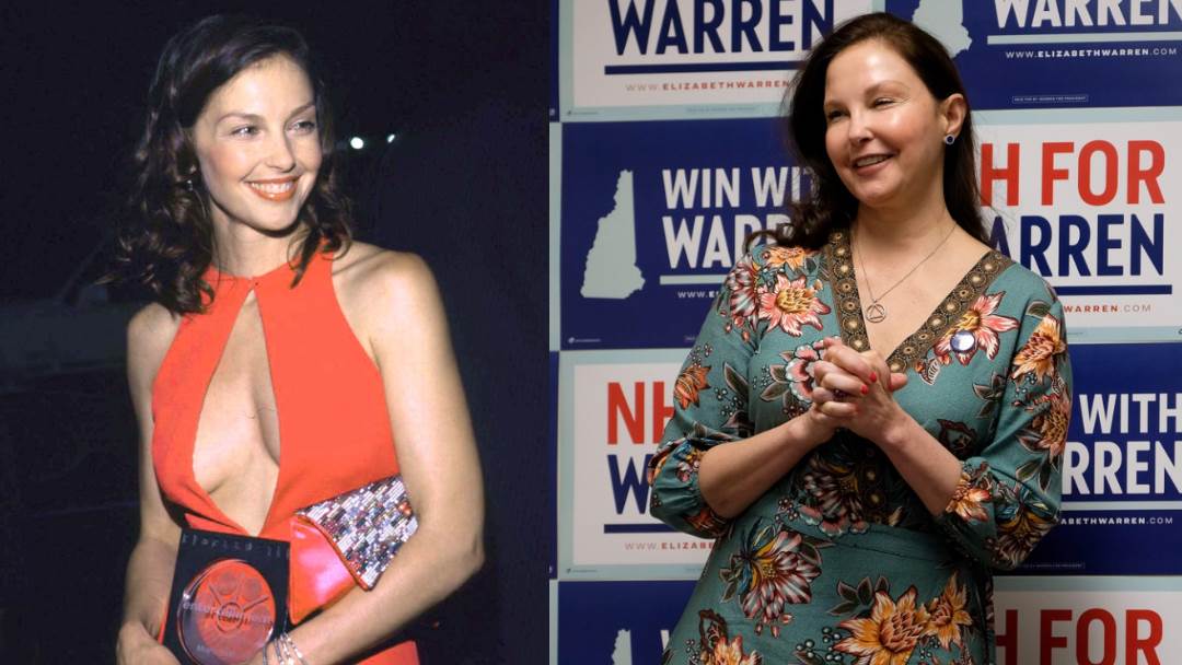 Ashley Judd prije i poslije botoksa