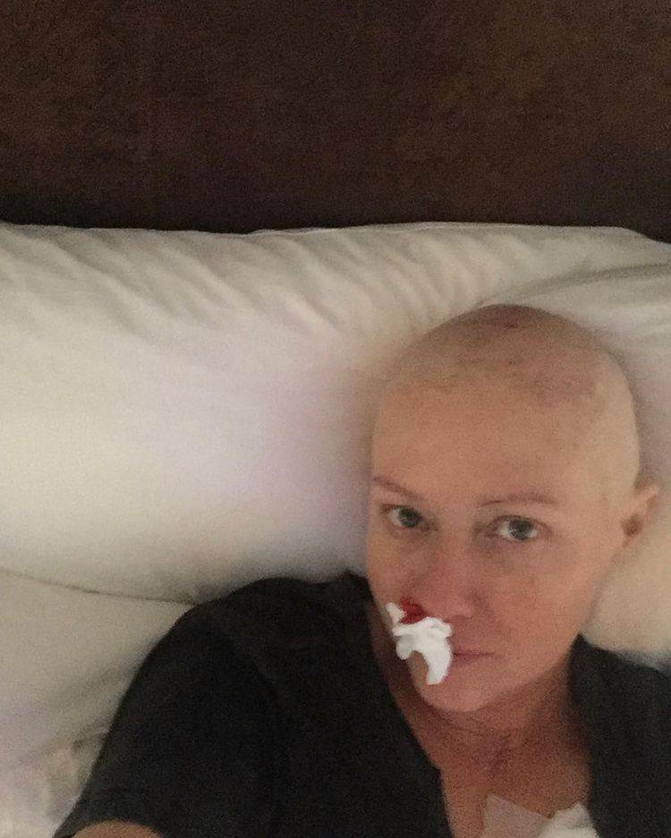 Shannen Doherty ima rak u četvrtom stadiju