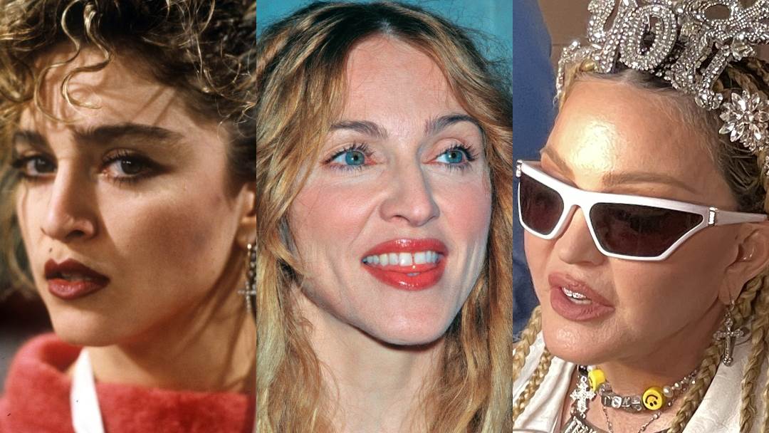 Madonna je uništila izgled plastičnim operacijama