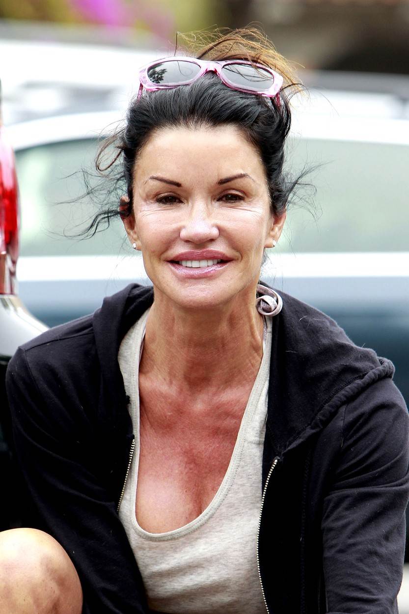 Janice Dickinson svoje je lice uništila plastičnim operacijama