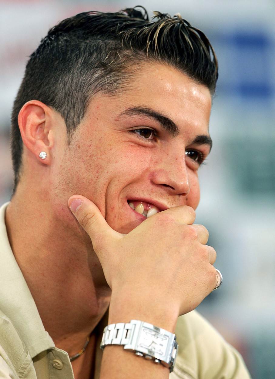 Cristiano Ronaldo nekada nije imao savršen osmijeh kao danas