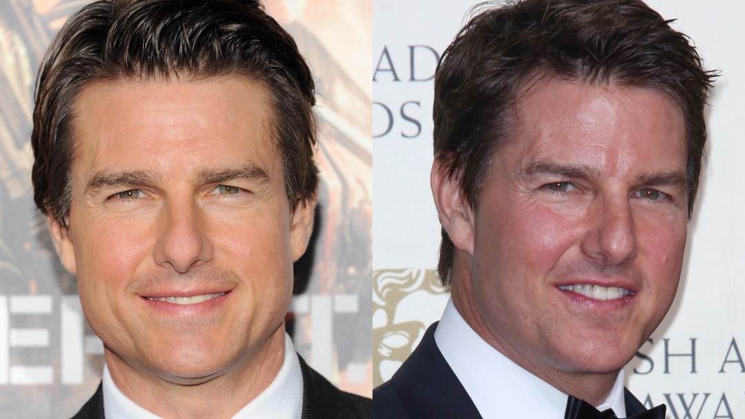Tom Cruise išao je pod nož