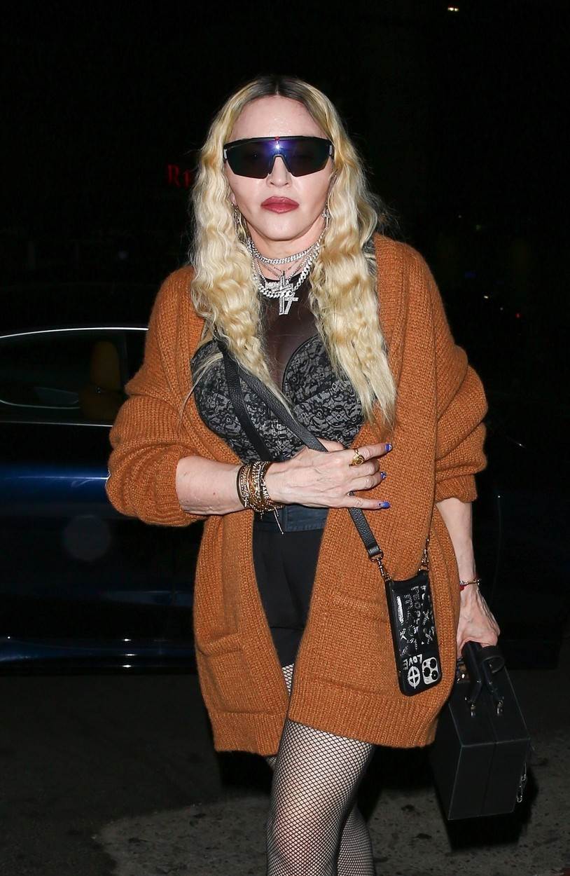 Madonna je potpuno promijenila izgled plastičnim operacijama