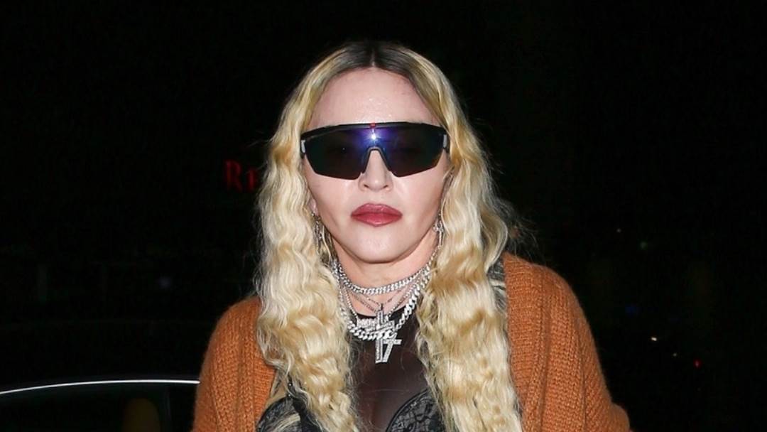 Madonna je napravila niz zahvata na licu