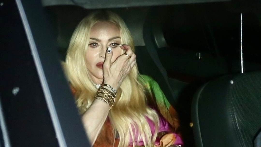 Madonna je izgled uništila plastičnim operacijama