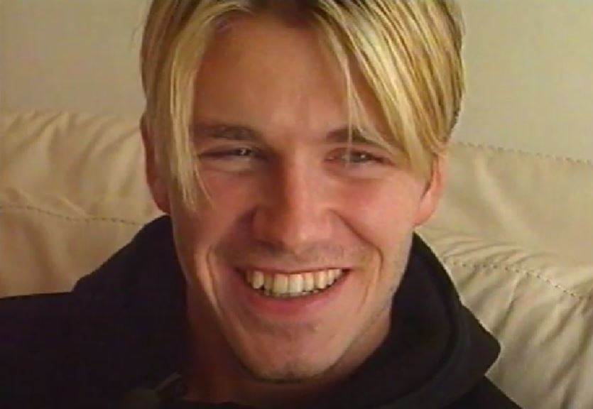 David Beckham imao je nepravilne zube