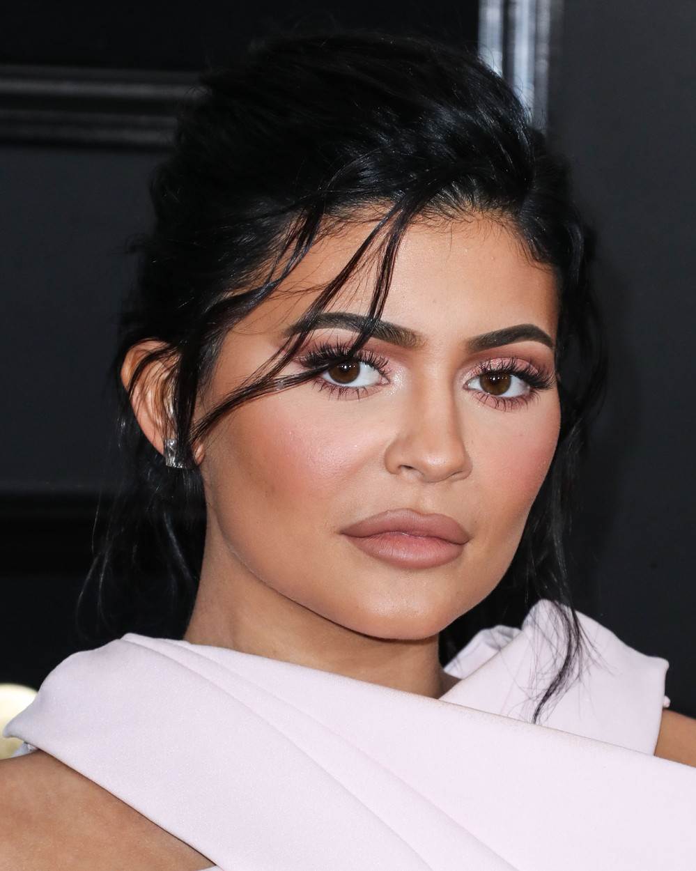 Kylie Jenner gornja usnica se iskrivila od filera