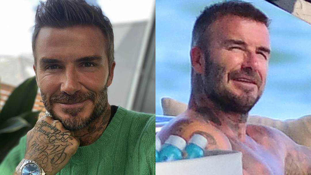 David Beckham koristi botoks