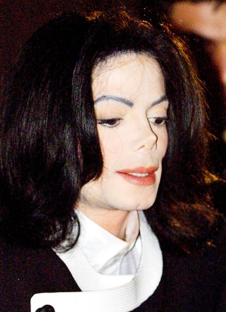Michael Jackson je bio ovisan o estetskoj kirurgiji