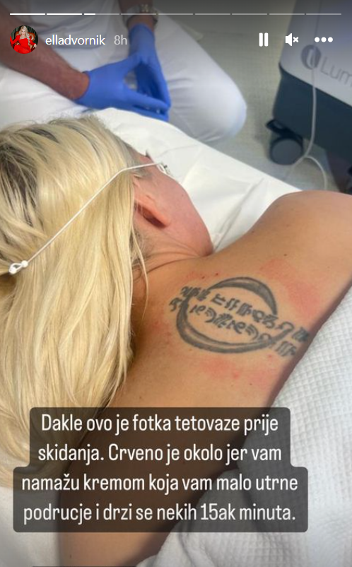 Ella Dvornik skida tetovažu na leđima