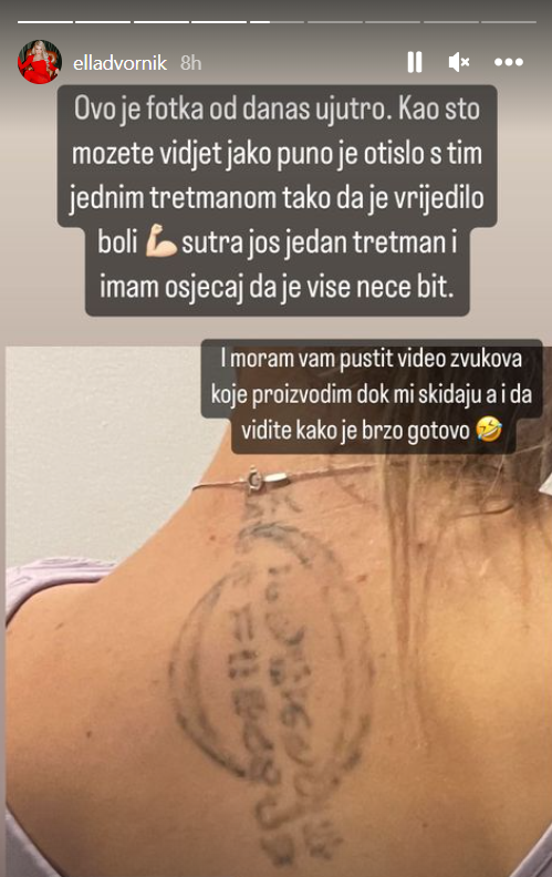 Ella Dvornik skida tetovažu na leđima
