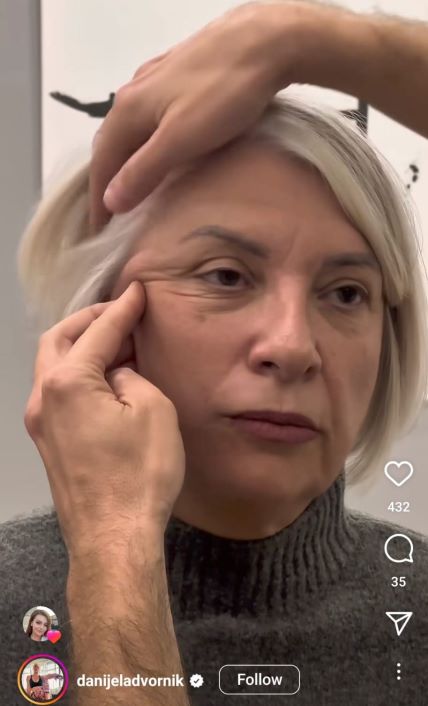 Danijela Dvornik je sebi za 58. rođendan poklonila facelifting