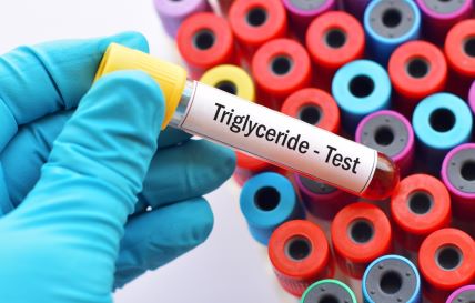 Trigliceridi.jpg