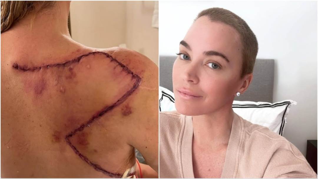 Teddi Mellencamp je teško bolesna