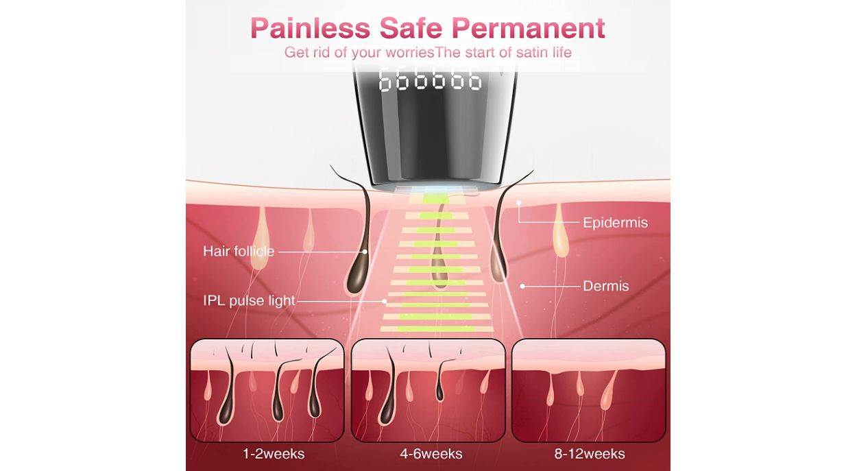 Već ovo ljeto uz IPL laser trajno uklonite dlačice