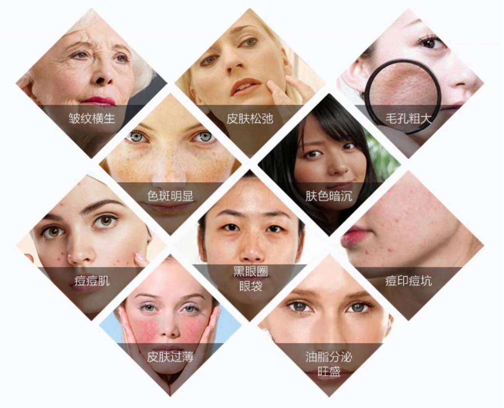 Uređaj za pomlađivanja kože 4