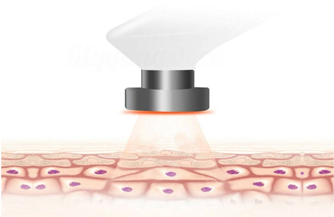 Uređaj za podizanje lica 5.jpg