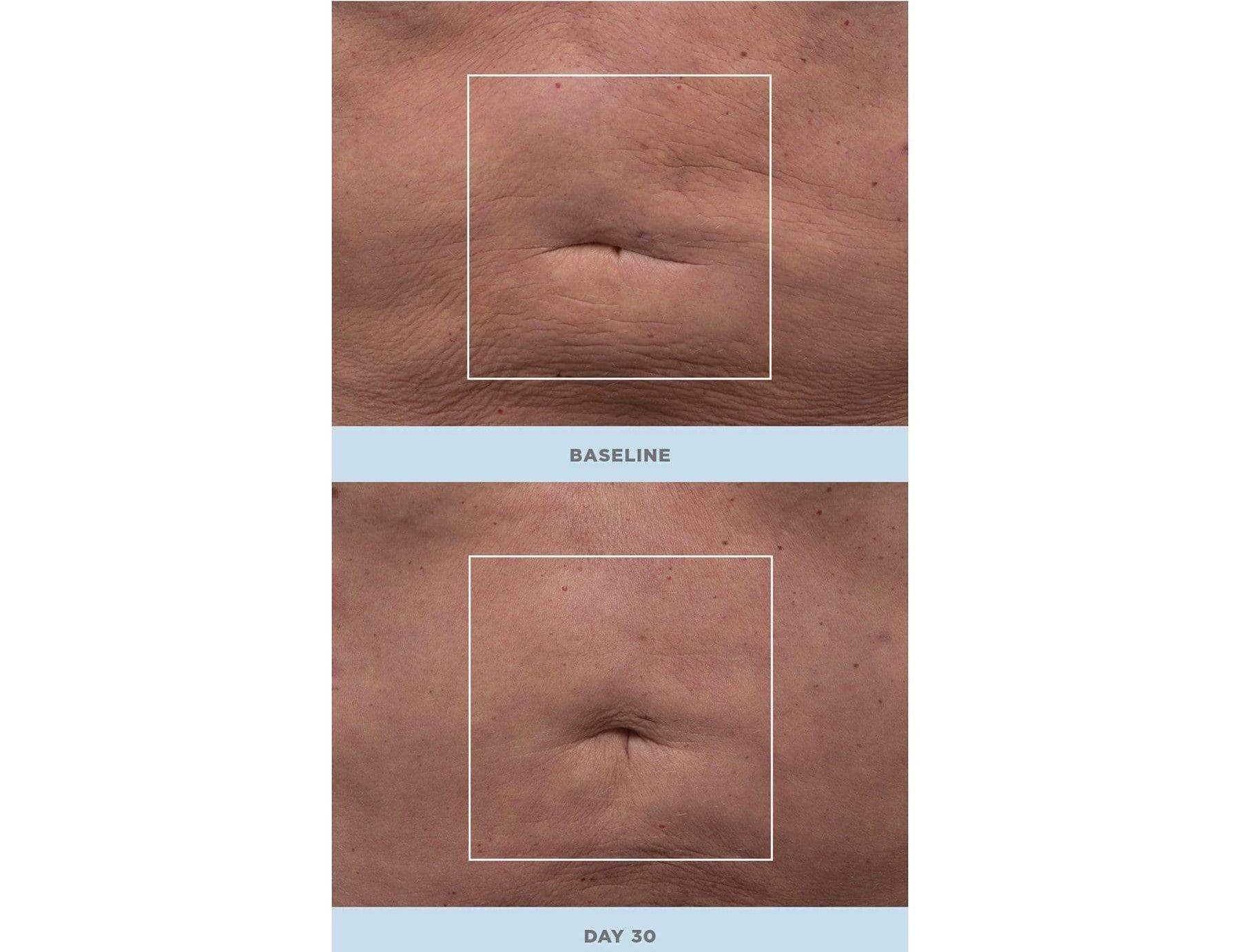 Nuface NuBody (3).jpg