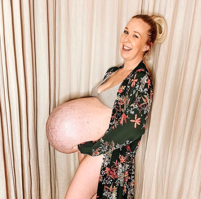 Kako izgleda trbuh trudnice koja nosi trojke