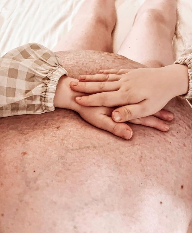 Kako izgleda trbuh trudnice koja nosi trojke