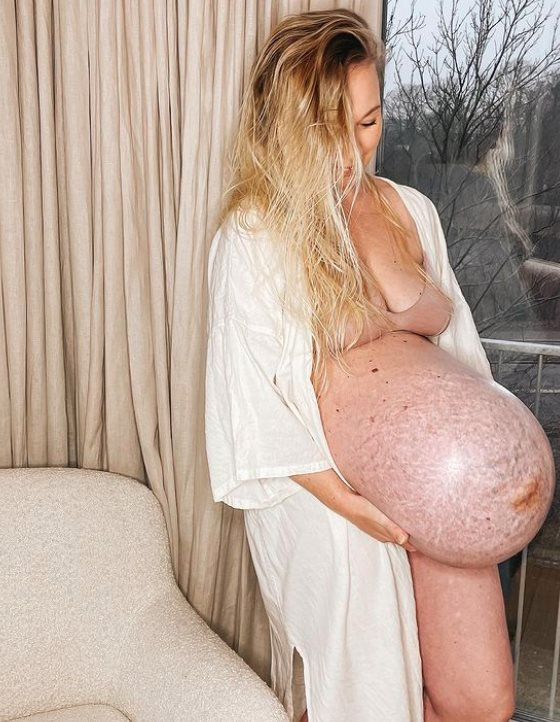 Kako izgleda trbuh trudnice koja nosi trojke