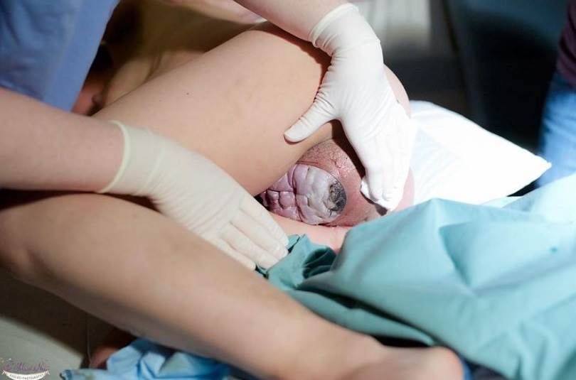 Stvarne fotografije s poroda