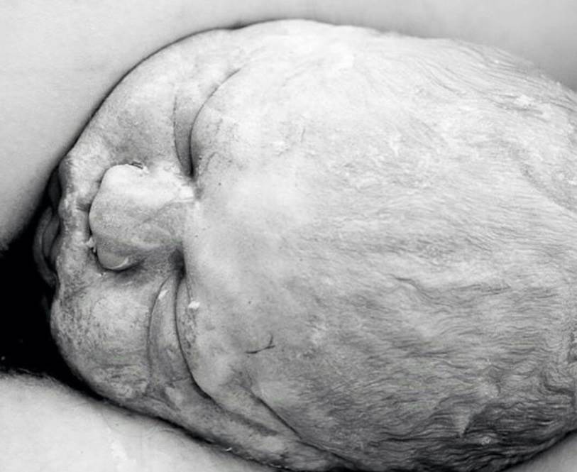 Stvarne fotografije s poroda