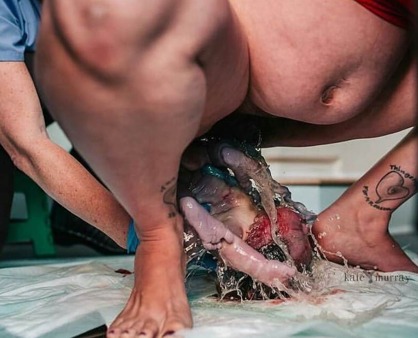 Stvarne fotografije s poroda