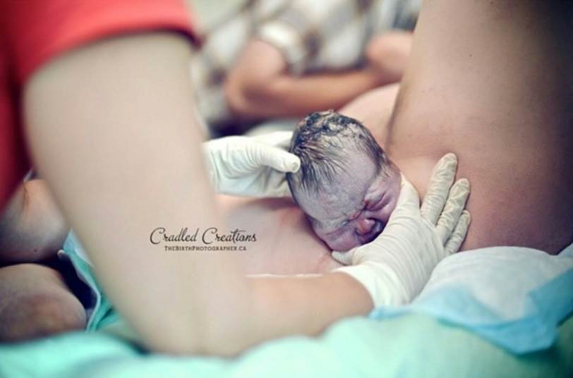 Stvarne fotografije s poroda