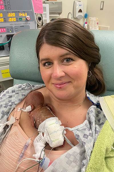 Najranije rođena beba na svijetu - 283 grama u 21. tjednu trudnoće