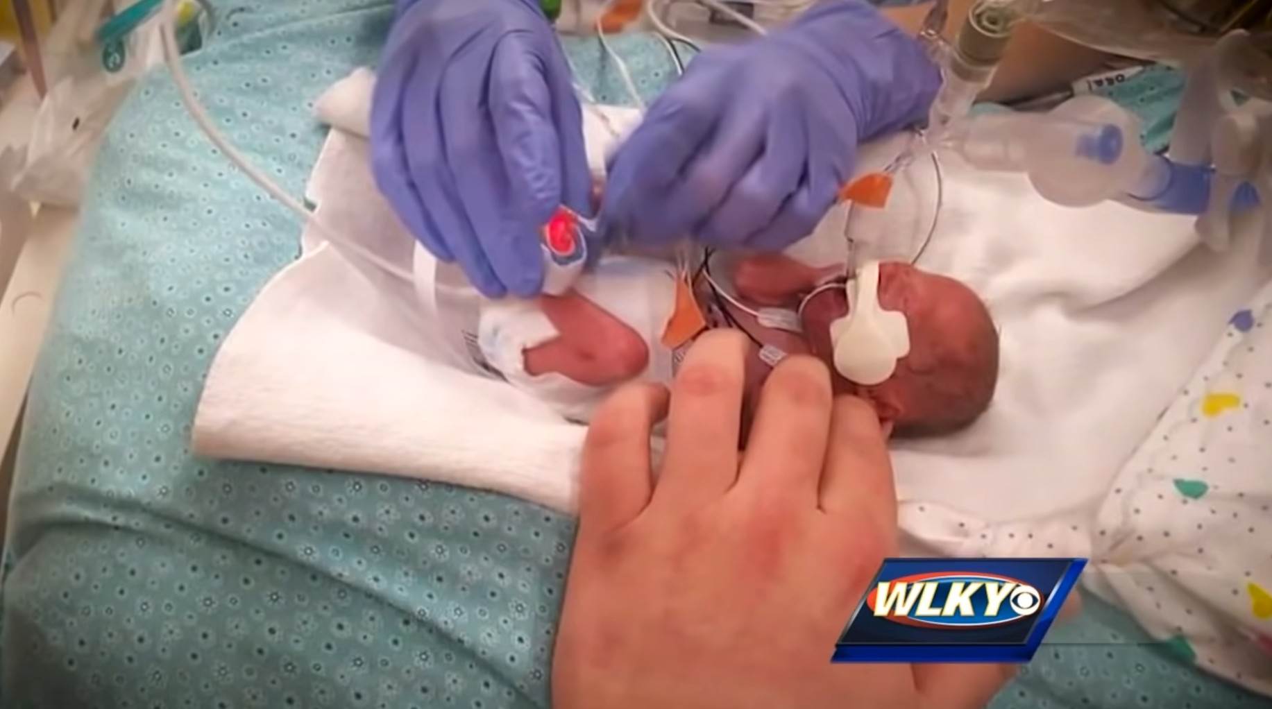 Patuljasti rast kod beba