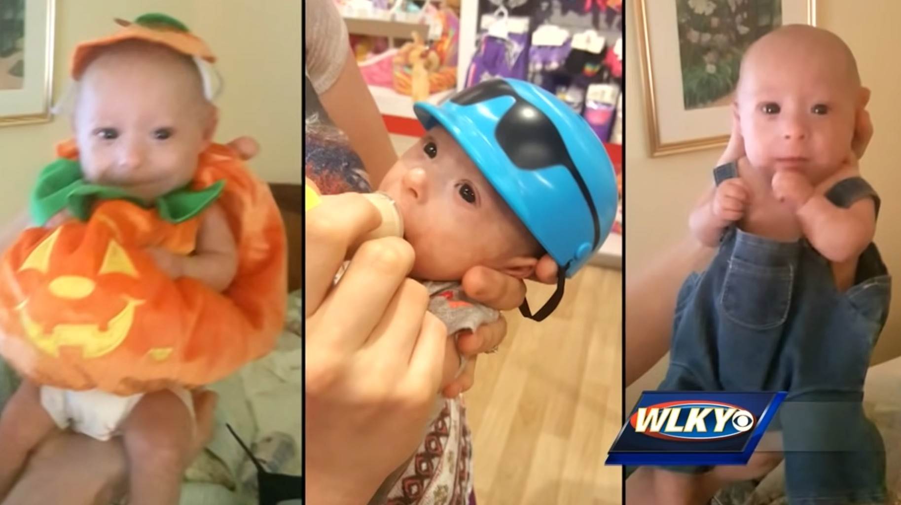 Patuljasti rast kod beba