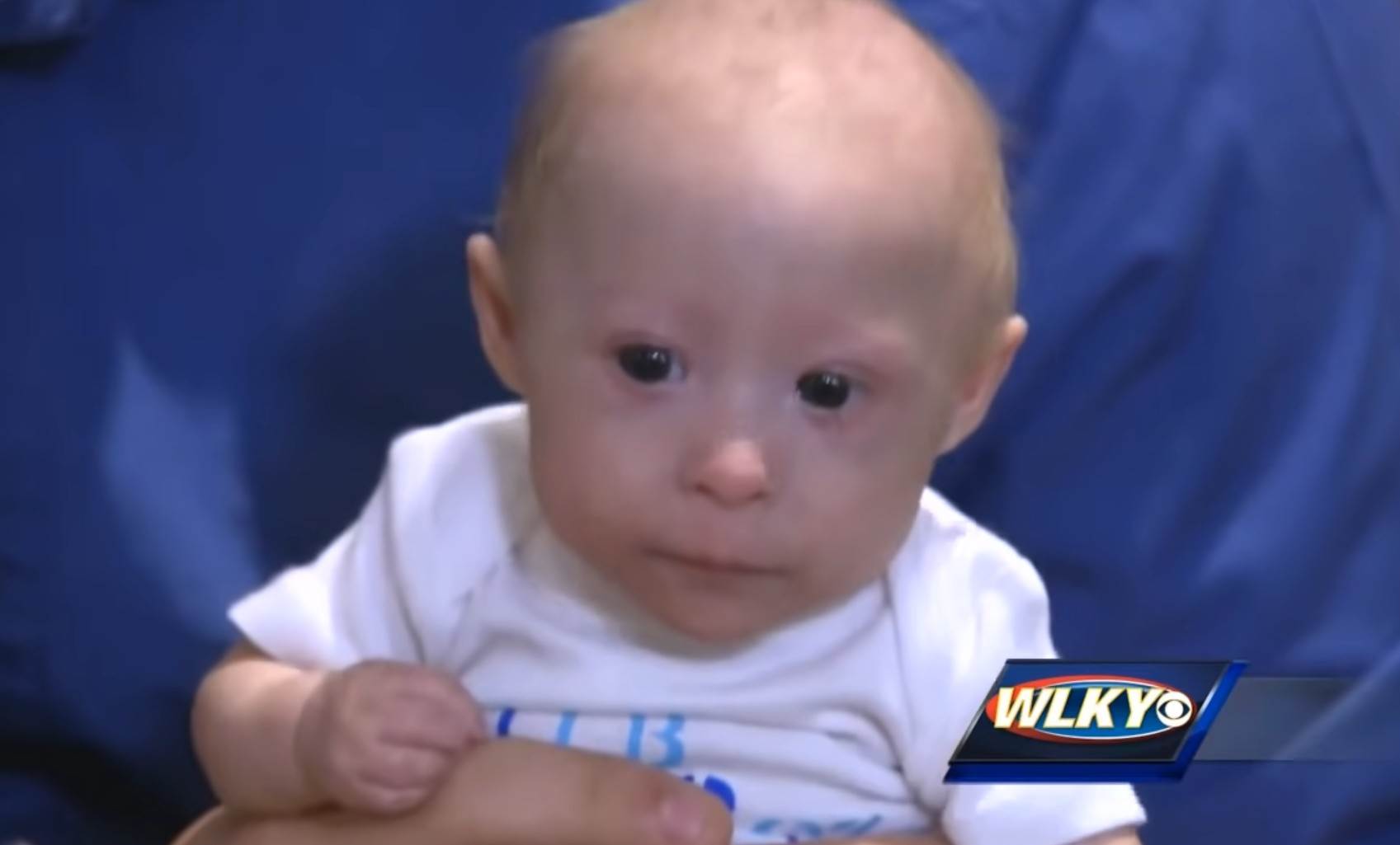 Patuljasti rast kod beba