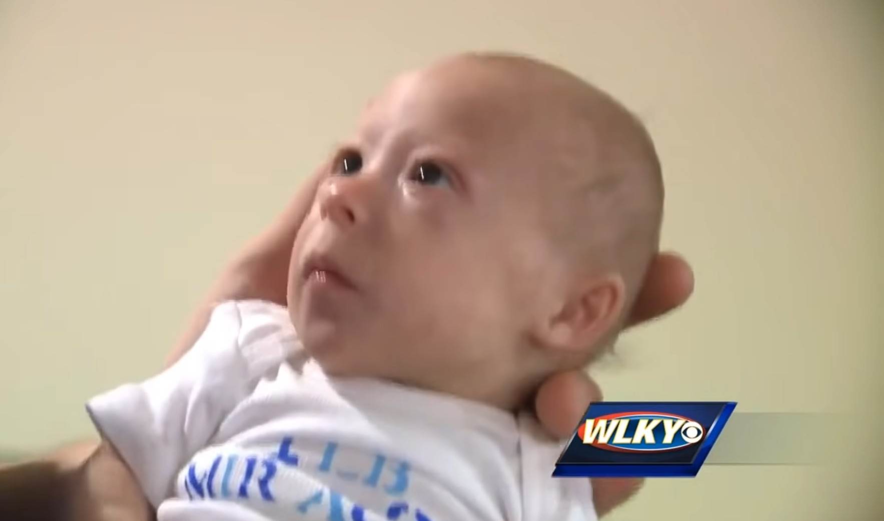 Patuljasti rast kod beba