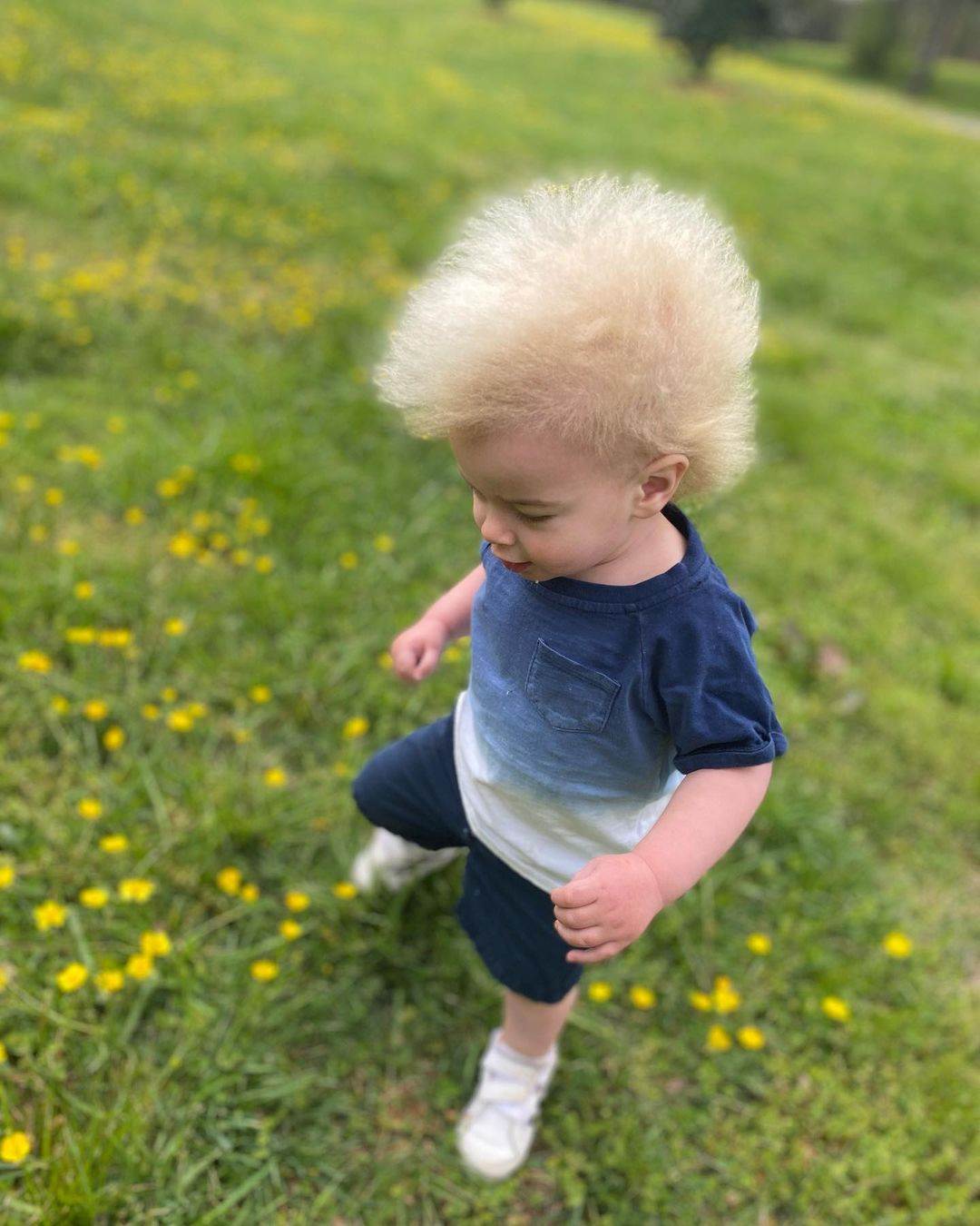 Locklan Samples je djecak s rijetkim genetskim poremecajem