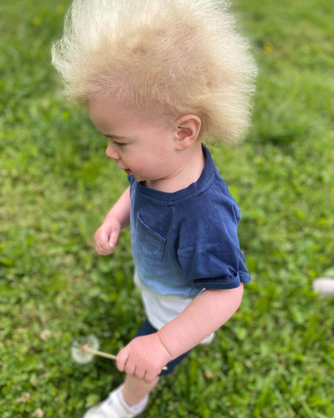 Locklan Samples je djecak s rijetkim genetskim poremecajem