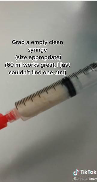 Medicinska sestra pokazala kako uzeti uzorak urina kod beba