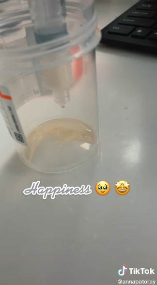 Medicinska sestra pokazala kako uzeti uzorak urina kod beba