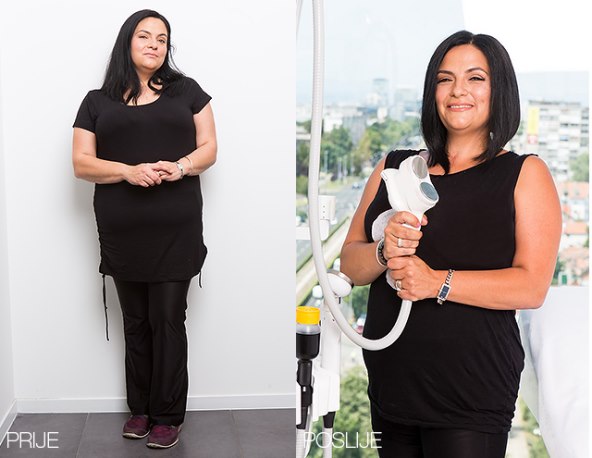 Poliklinika Bagatin i Story predstavljaju drugu makeover pobjednicu