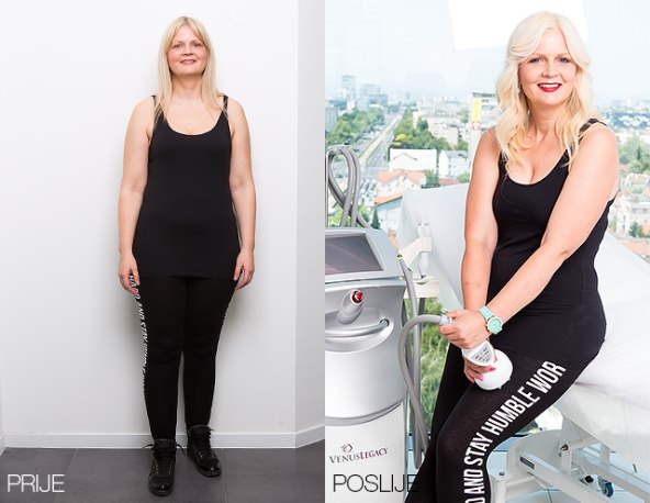 Poliklinika Bagatin i Story predstavljaju treću makeover pobjednicu