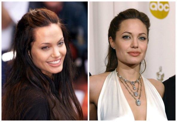 Anti - aging tretmani u 30 -im godinama