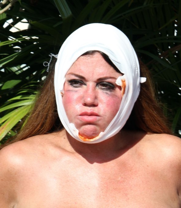 Izašla iz Big Brothera pa šokirala plastičnim operacijama