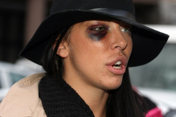 Nakon što je pretukao djevojku, voditelj se potajno oženio